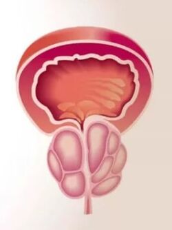 Upala prostate